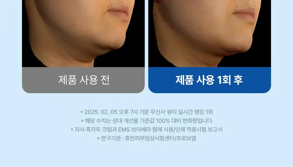 [7월 올영픽/디바이스골라담기] 마미케어 브이쎄라 / 펜타프라임 택 1 상세페이지 12